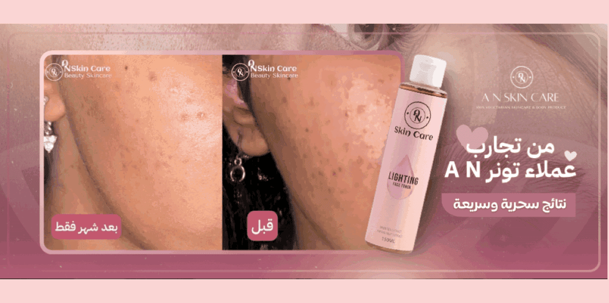 تجارب تونر AN